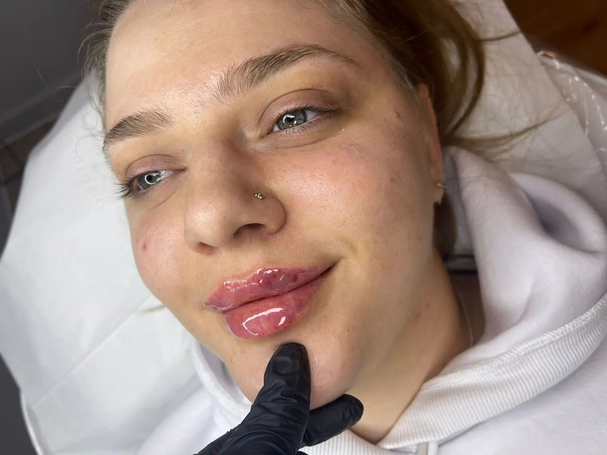 How Injectables Can Enhance Natural Beauty Safely