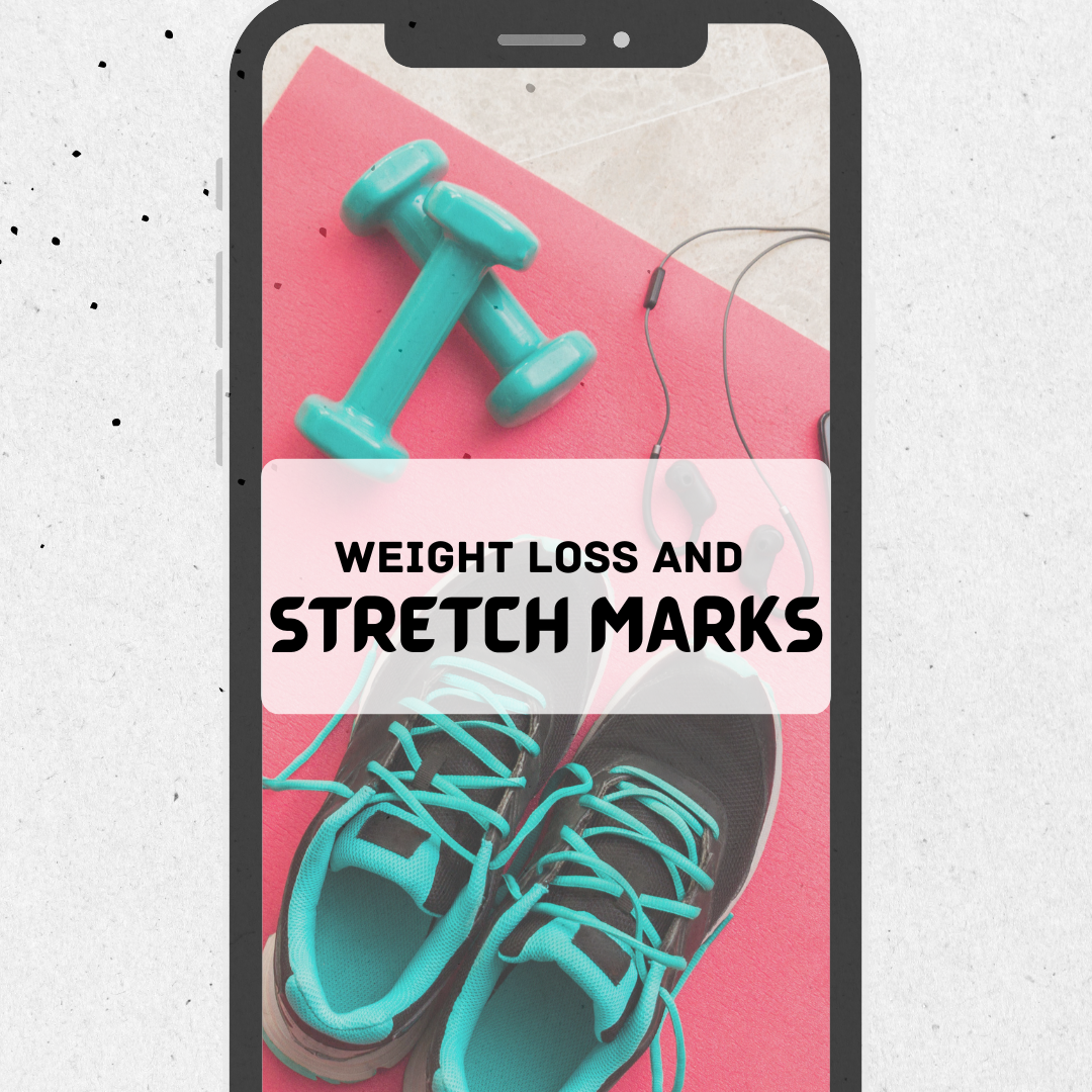 The Stretch Mark Dilemma: Can Weight Loss Leave Its Mark?