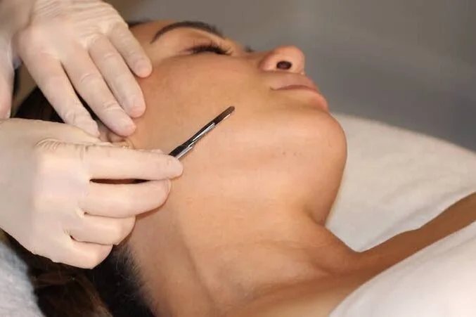 Dermaplaning: Myths, Truths, Benefits, and More!