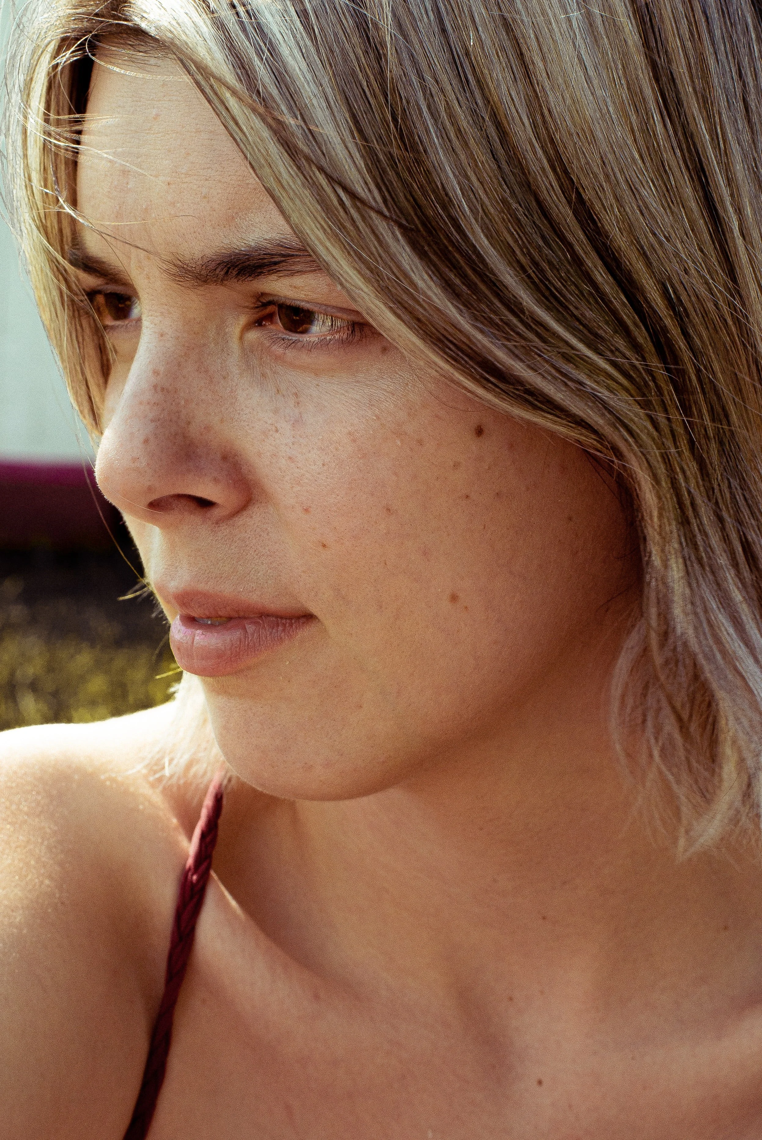 Are There Treatments for Sun Spot Removal?