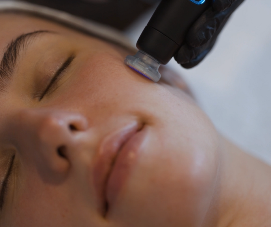CoolJet Plasma with Exosomes treatment for collagen renewal at JE'DERM skin atelier Upper West Side NYC