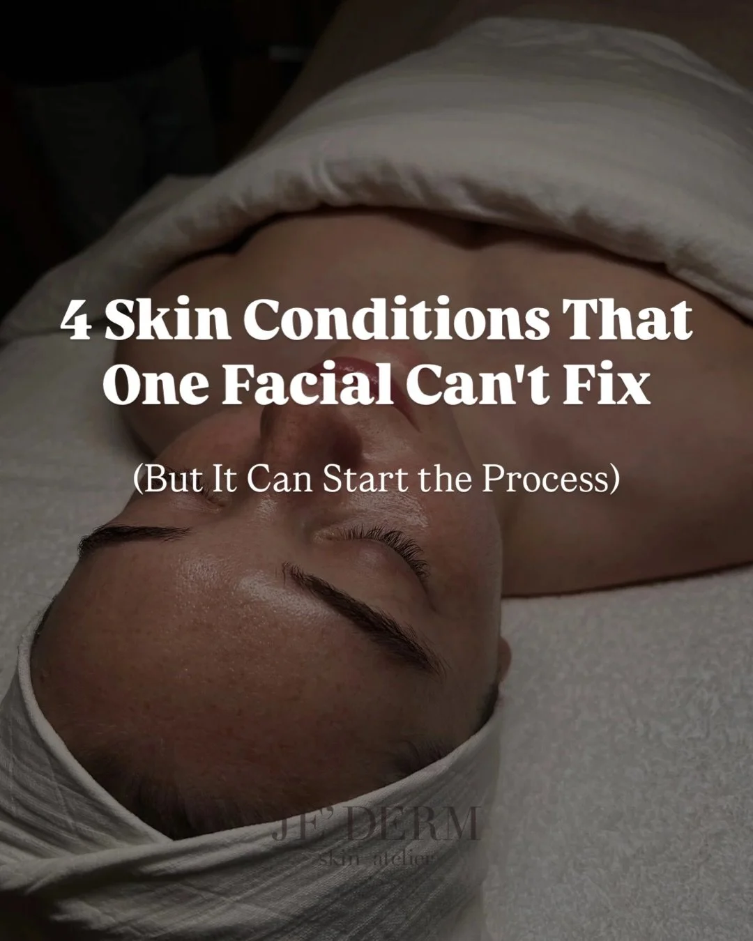 Skin requires commitment, not a miracle. Real results take time, and while we would all love a magic 🧚🏻 solution, consistency is what delivers both visible improvements and long term skin health, keeping the skin strong and youthful.

#jedermskinat