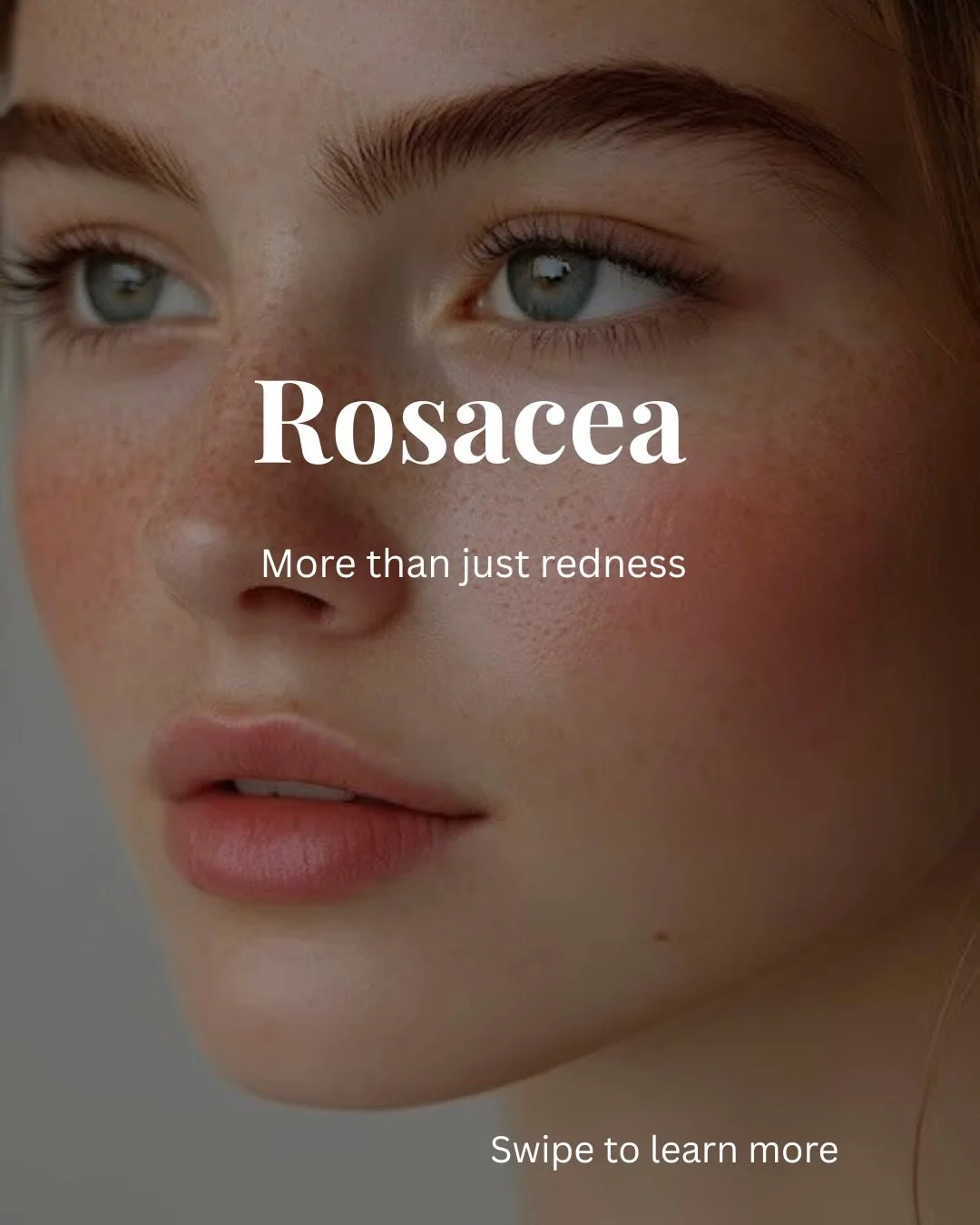 As rosacea awareness month comes to a close, caring for this skin remains ongoing both in your daily routine and in how it&rsquo;s supported over time.
These 👆🏻are the kinds of things worth being aware of. 

P.S. If you have rosacea, facials can st