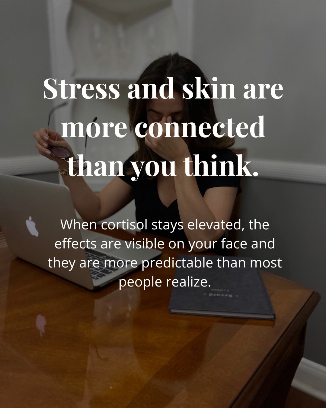 Stress is one of the most underestimated factors in skin aging. Not because people do not know it matters, but because the biology behind it is rarely explained clearly. 

Swipe through to understand exactly what is happening in your skin during dema