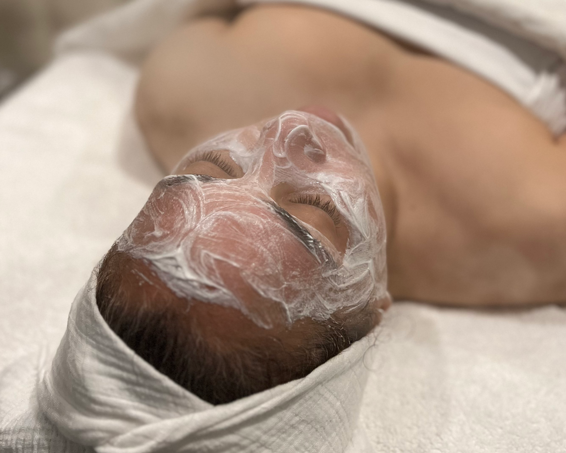 Chemical Peels After Summer: Why Fall Is the Season for a Deeper Reset