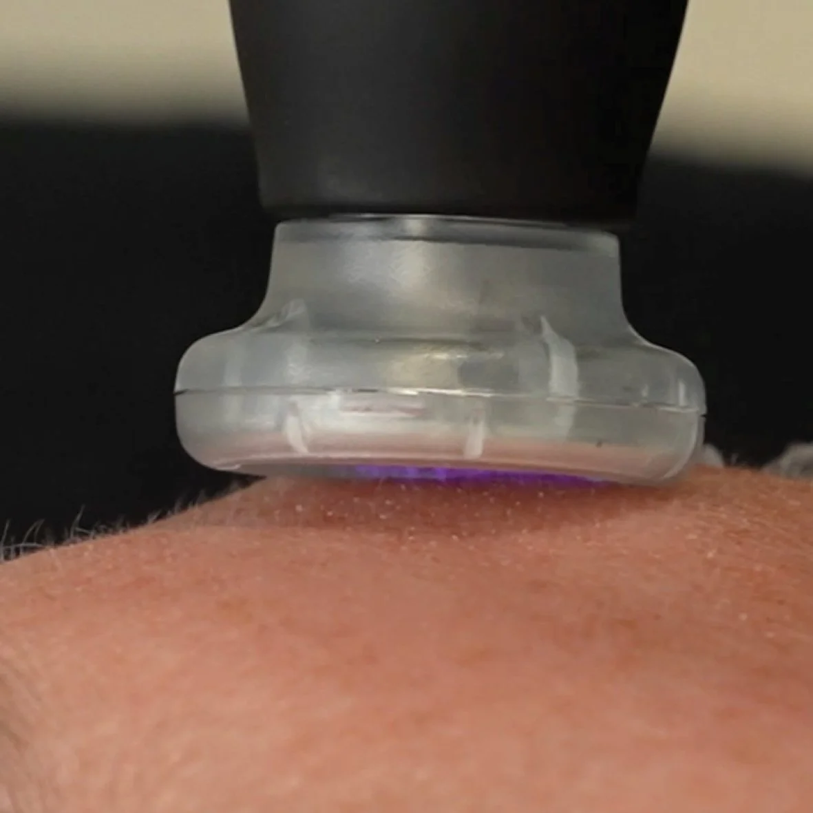 CoolJet Plasma treatment for rosacea and sensitive skin at JE'DERM skin atelier