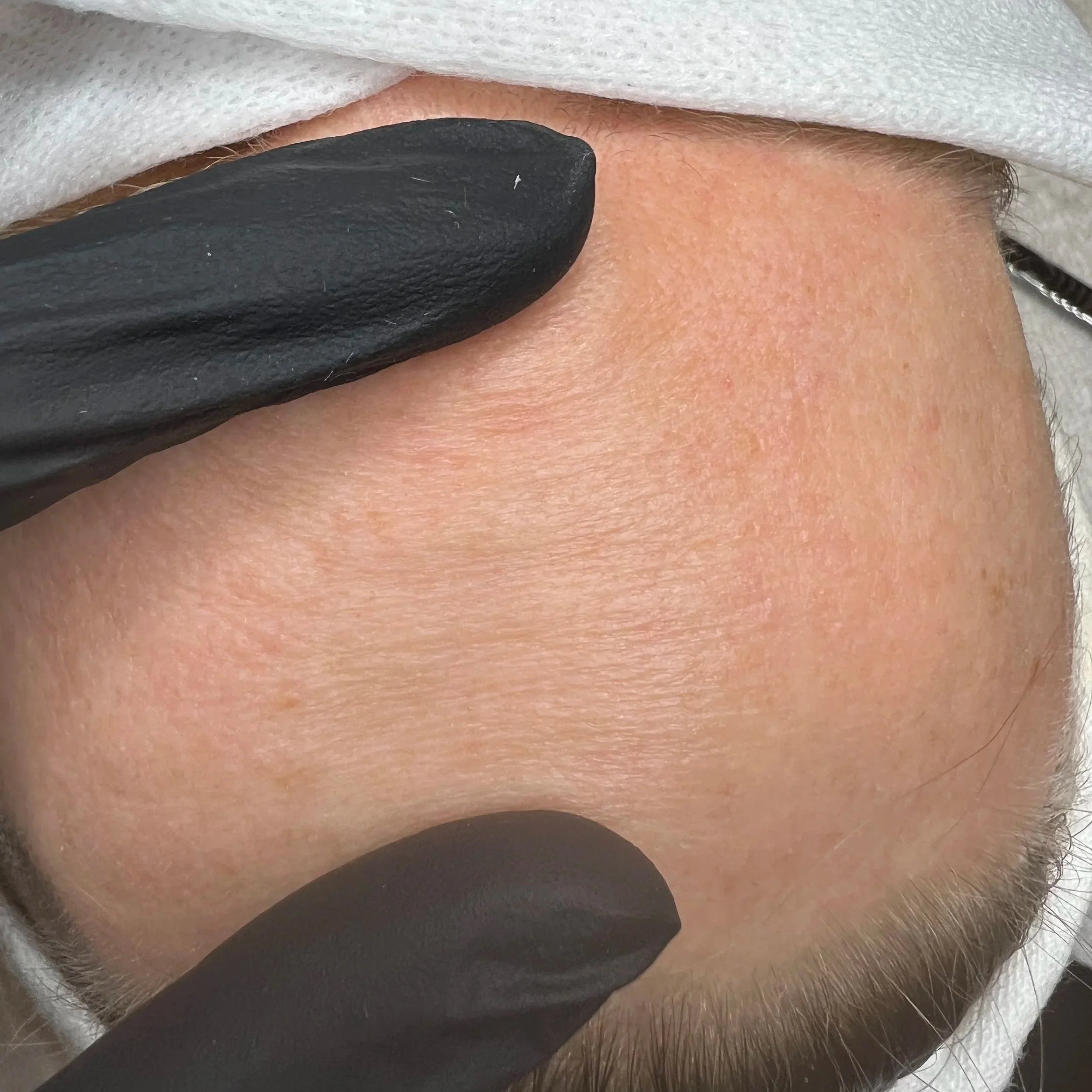 Close up of dry, dull skin with visible rough, flaky texture