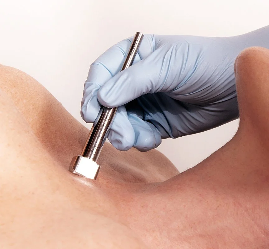 Body microdermabrasion treatment being performed on a client's arm to exfoliate and smooth skin texture