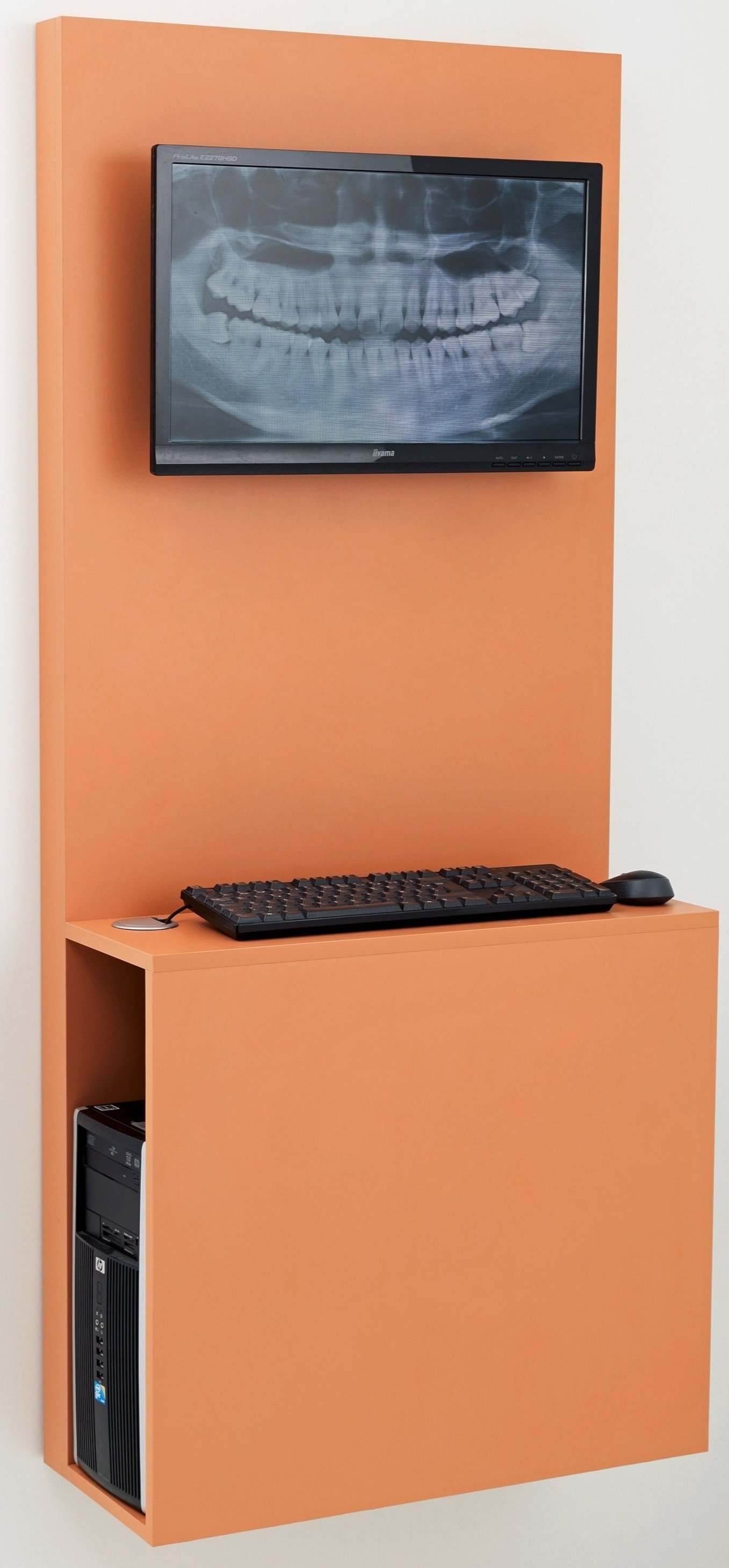 X%252BRAy%252Bcomputer%252BCabinet.jpg