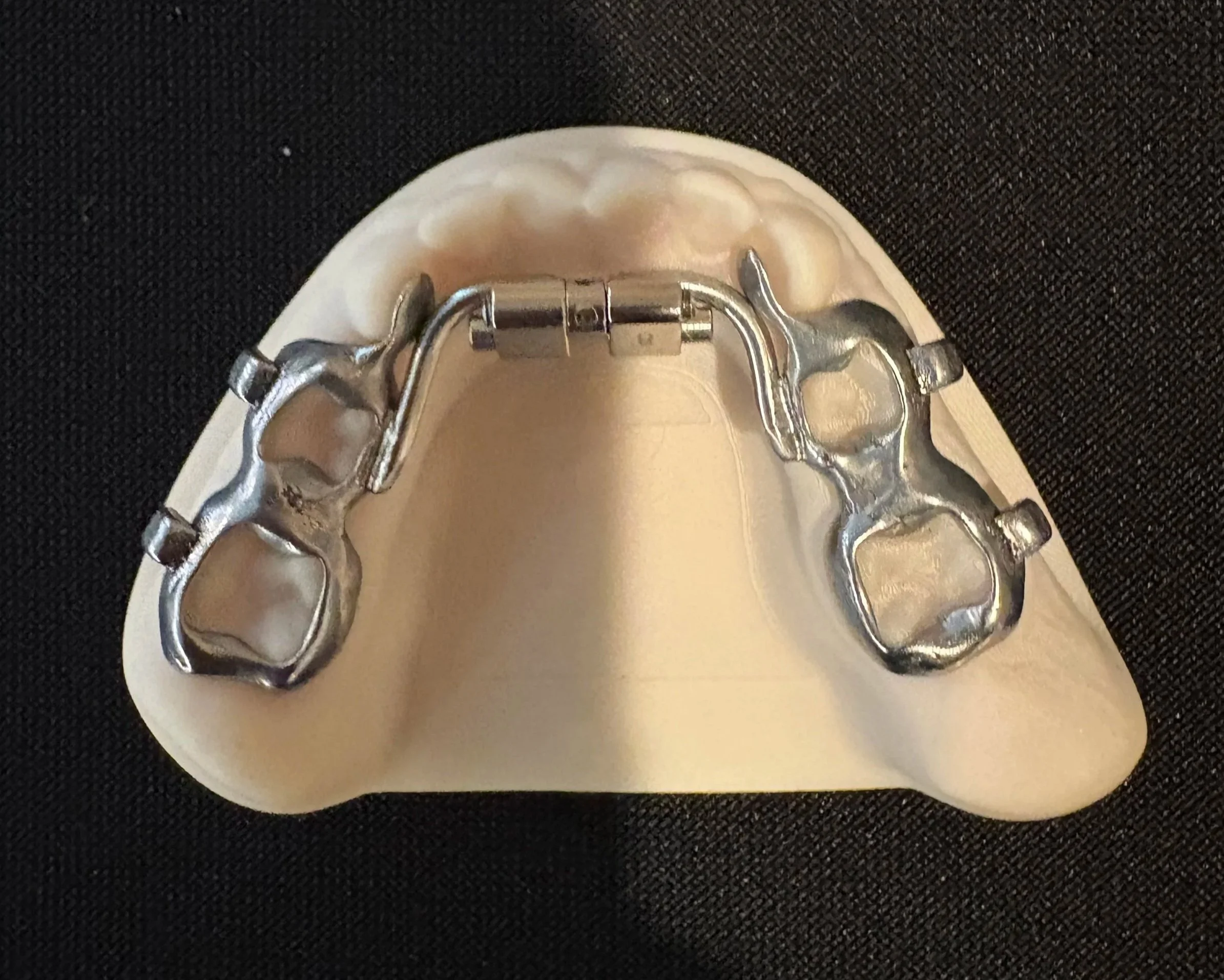 3D printed expander
