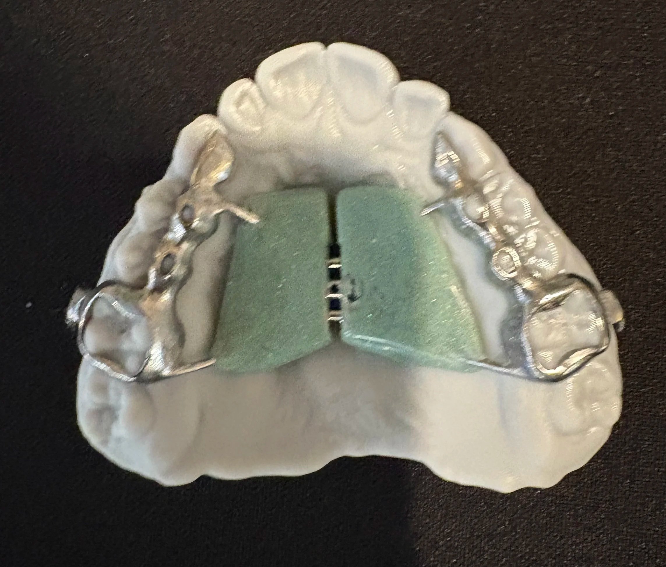 3D printed expander