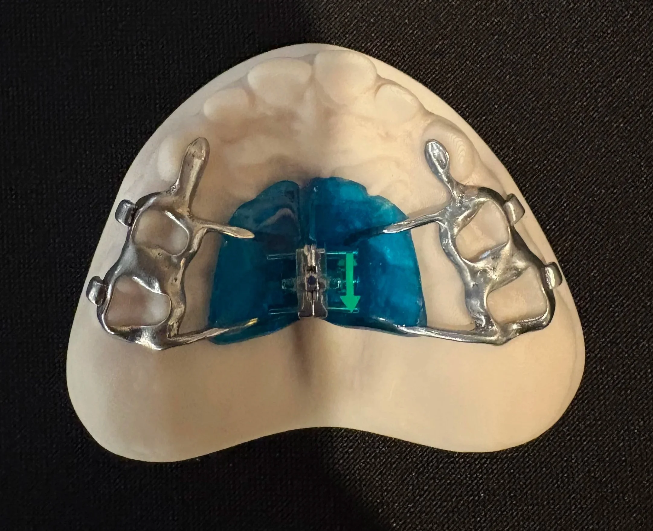 3D printed expander