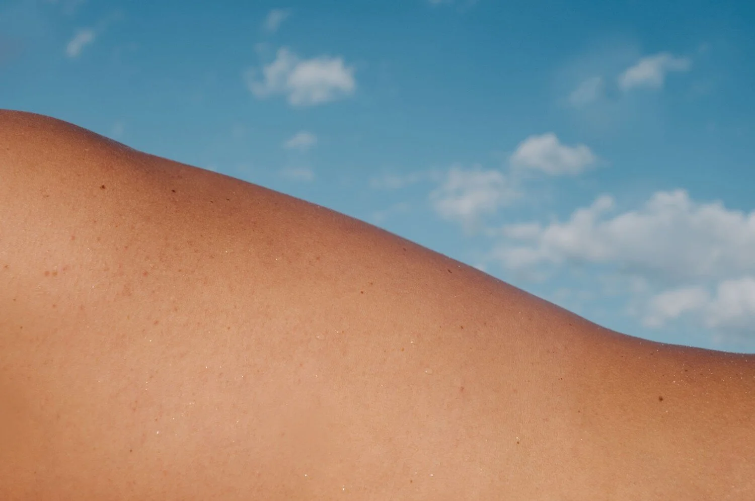 But What is Dry Needling Actually?