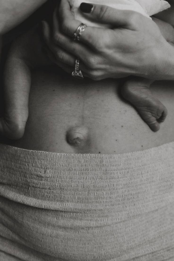 Close-up of woman’s belly with newborn baby feet resting gently, representing the transformative moment of birth.