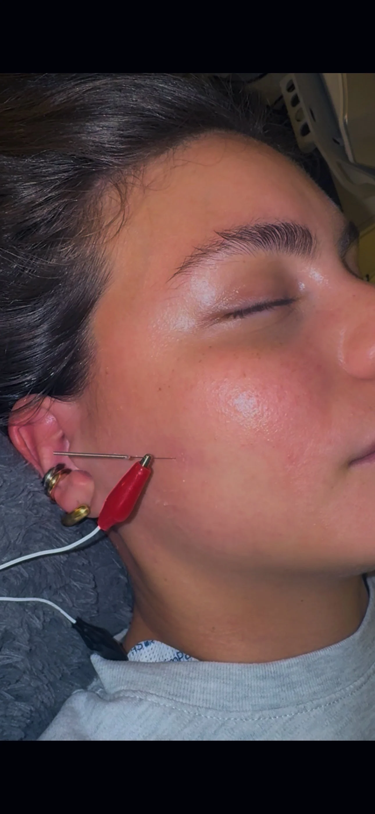 Fisioterapia invasiva y ejercicios de reeducación.JPG