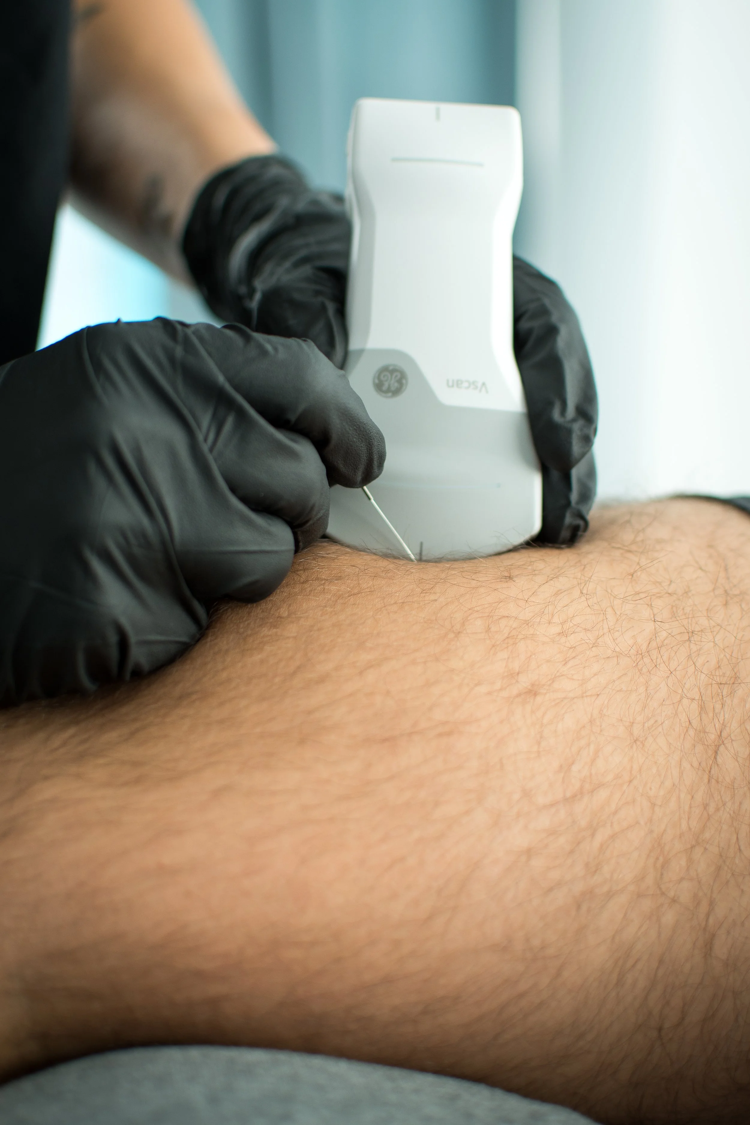 fisio chamartin fisioterapia Chamartin fisio cerca de mi masaje osteopatia puncion seca fisioterapica contractura muscular mejor clinica de fisio fisioterapia en Madrid fisio en Madrid masaje plaza castilla