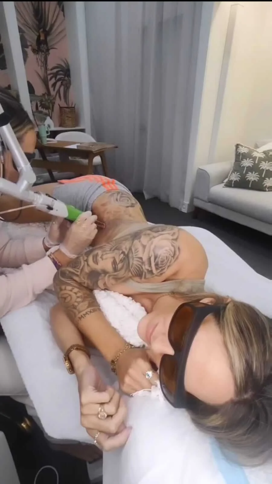 Ribs Tattoo removal.jpeg