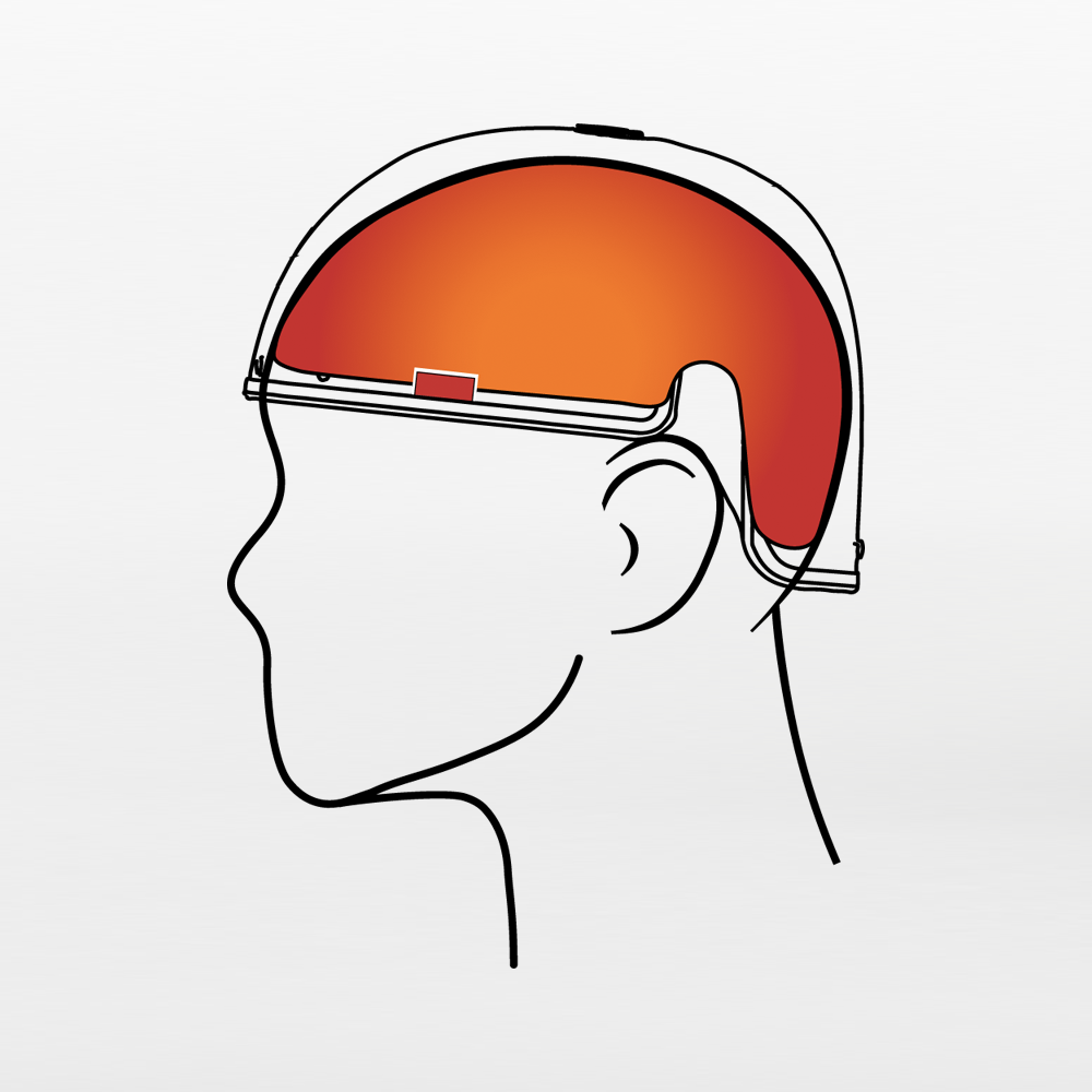 scalp-coverage.png