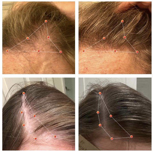 Female Before and After Revian.jpg
