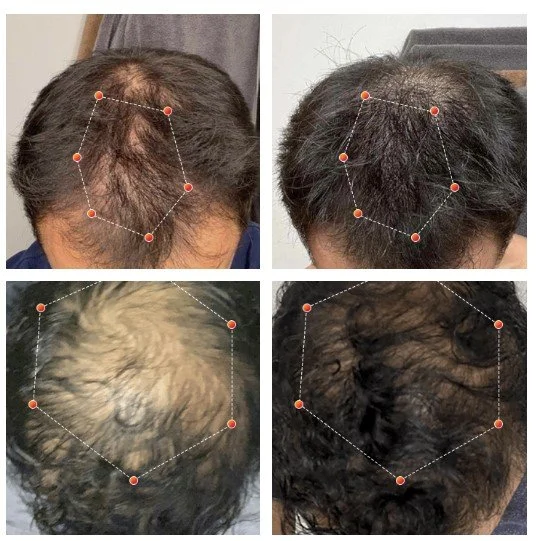 Male Before and After Revian.jpg