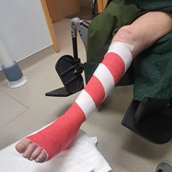Even wound care can get into the holiday spirit 🎄🎁
We had a little fun wrapping a special patient&rsquo;s wound like a candy cane &mdash; because healing doesn&rsquo;t have to feel cold or clinical.

At Wyoming Wound Care, we believe compassion, cr