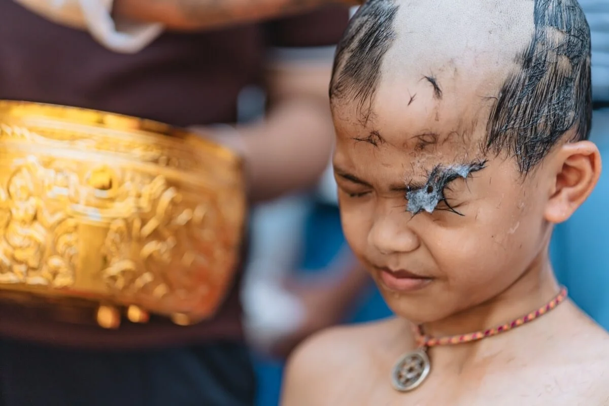 Boy's head is shaved.