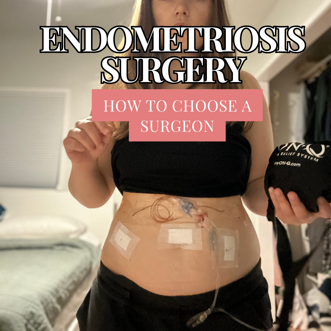 How to Choose an Endometriosis Surgeon