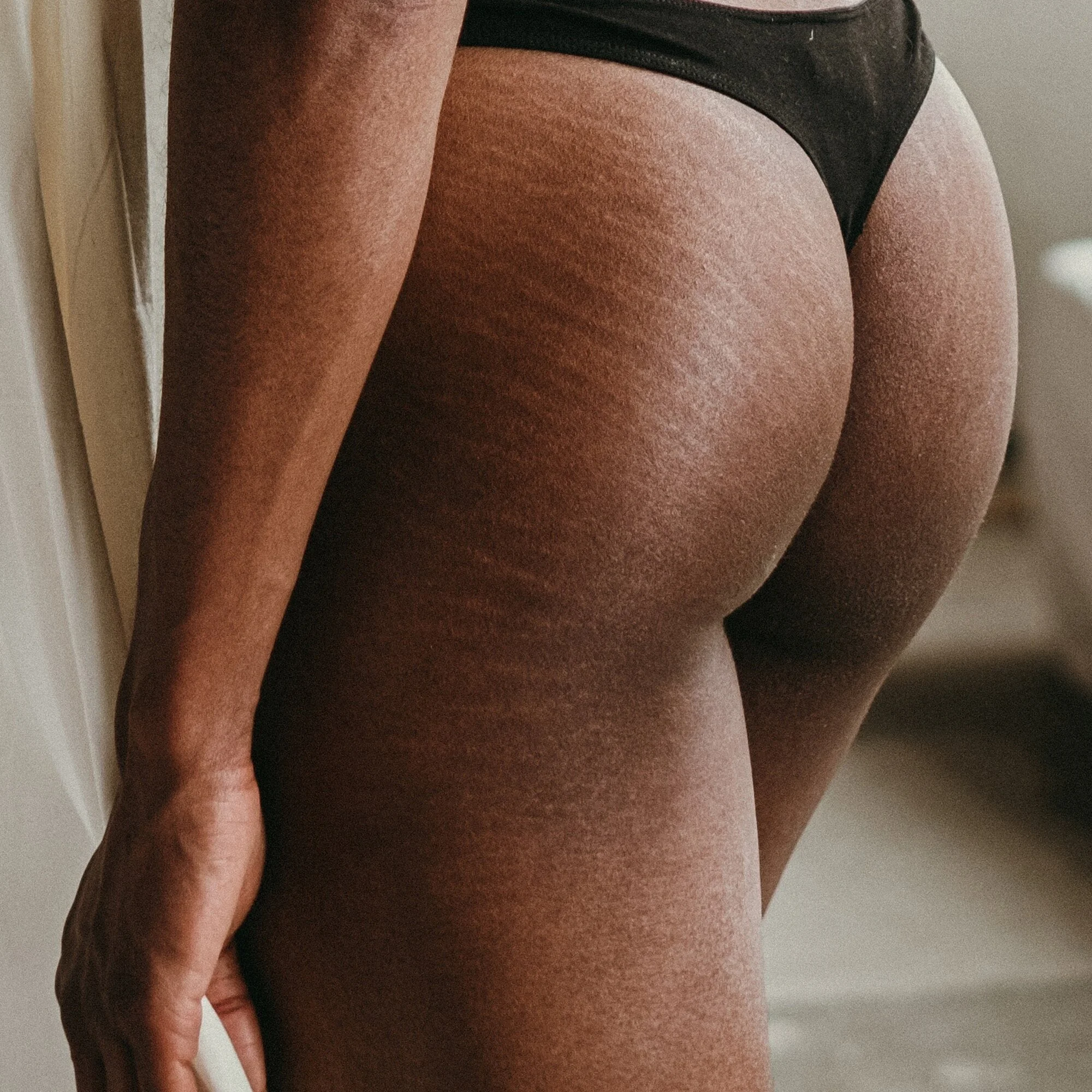 How to actually embrace skin acceptance