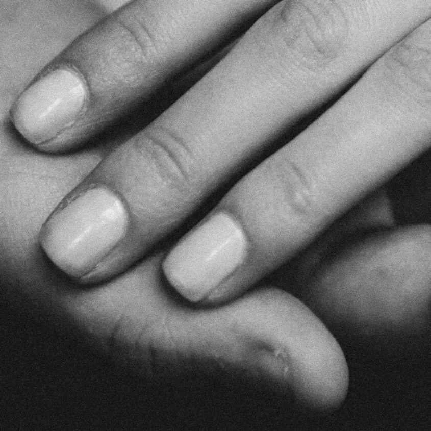 Lockdown is worsening people’s dermatillomania and making their skin picking compulsion feel inescapable