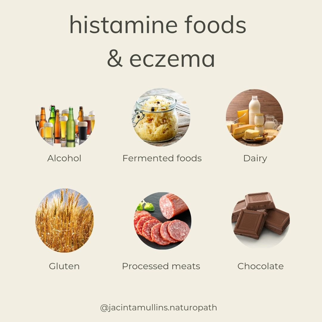 If you have eczema flare-ups after consuming foods high in histamine, here is why. 👇

Histamine is metabolised through two main pathways; DAO and HNMT. In eczema patients with histamine intolerance, there is often a decrease in DAO activity. 

Nearl