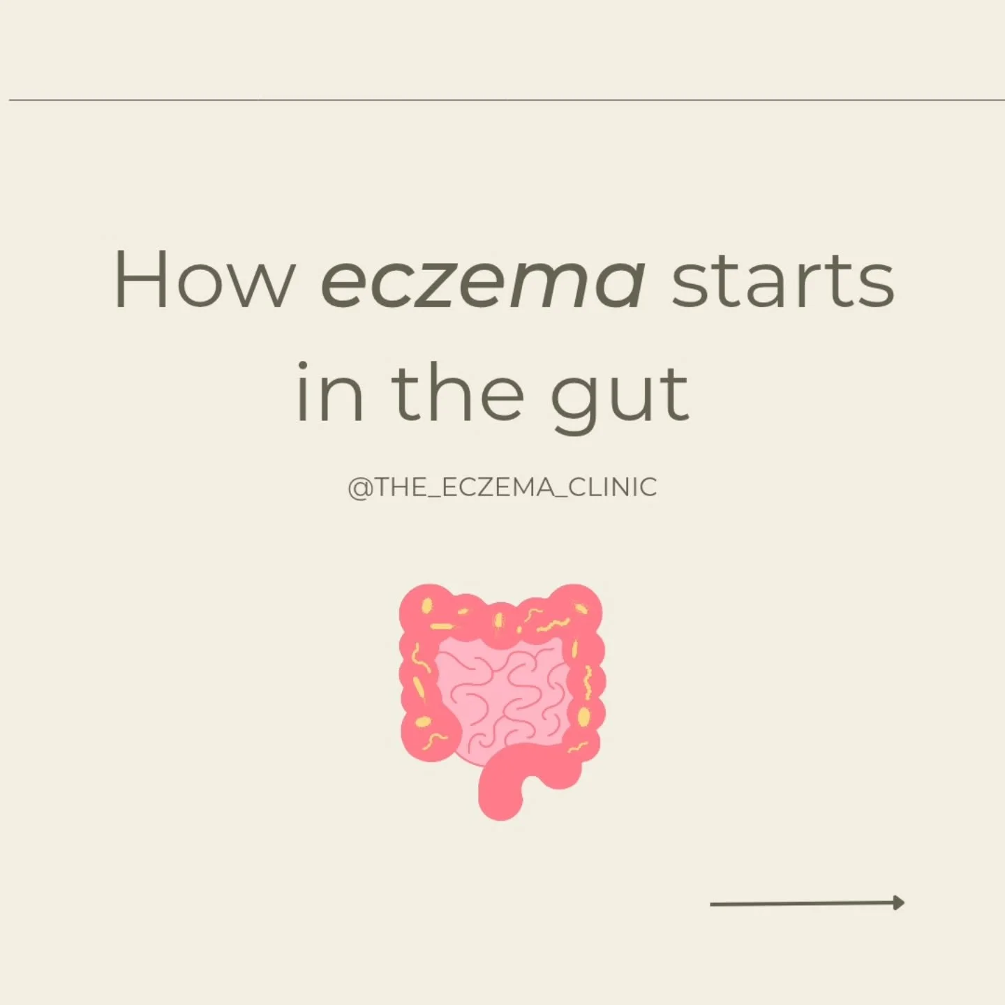 🌿 How gut imbalances trigger eczema 🌿

Did you know your gut and skin are deeply connected? When your gut is imbalanced - whether from stress, lifestyle choices or poor diet - it can lead to inflammation, food sensitivities, and a weakened skin bar