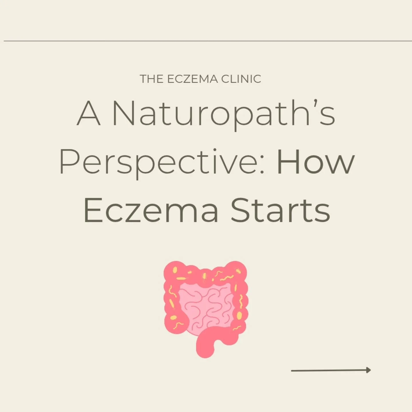 ❗️A Naturopath&rsquo;s Perspective: How eczema starts: 

Eczema is a chronic skin condition characterised by inflammation, redness, dryness, and intense itching. Eczema occurs when there is a dysregulated immune system, often caused by gut imbalances