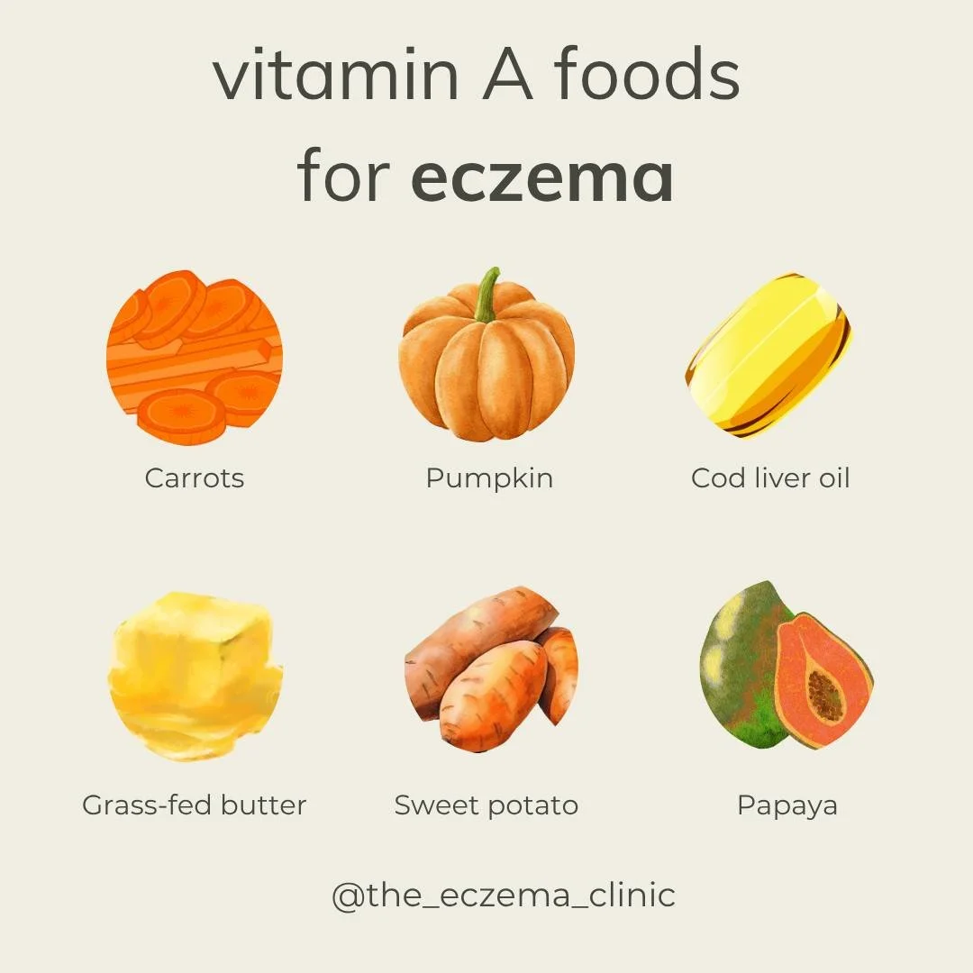 VITAMIN A AND ECZEMA:

Vitamin A is beneficial for eczema and overall skin health due to its crucial role in skin maintenance and repair. Read below for how vitamin A can help manage eczema:

🔸️ Promotes skin repair and maintenance 

🔸️ Anti-inflam