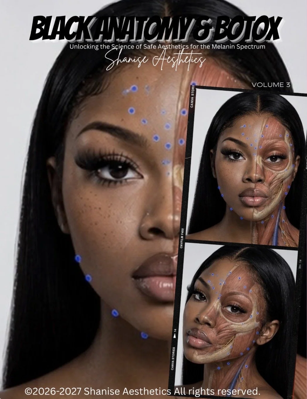 Black Anatomy & Botox Magazine