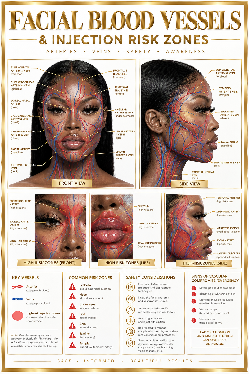 Facial Blood Vessels & Injection Risk Zones
