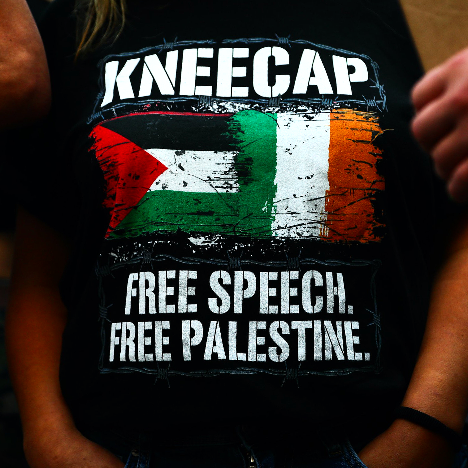 Kneecap