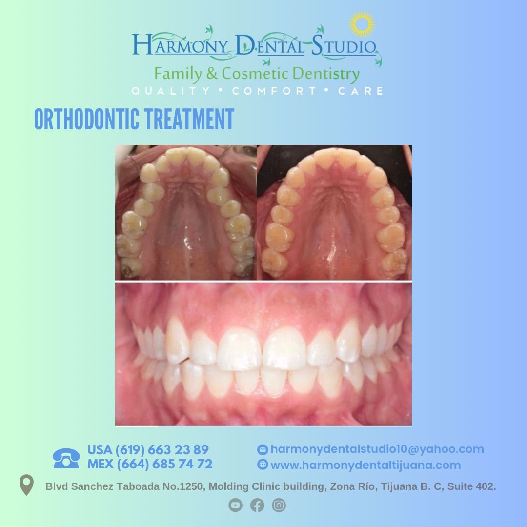 Orthodontic treatment .jpg