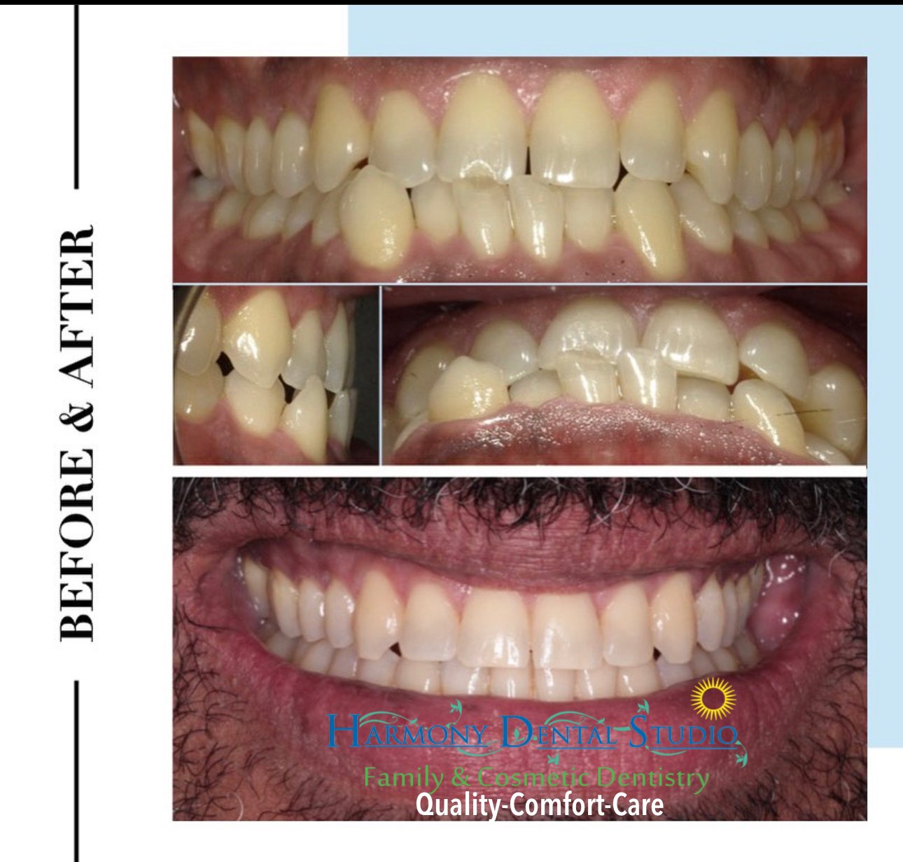 Orthodontics braces .jpg