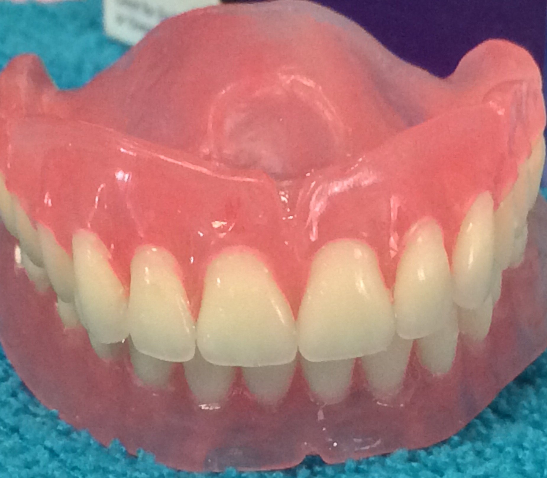 Full upper &lower dentures2.JPG