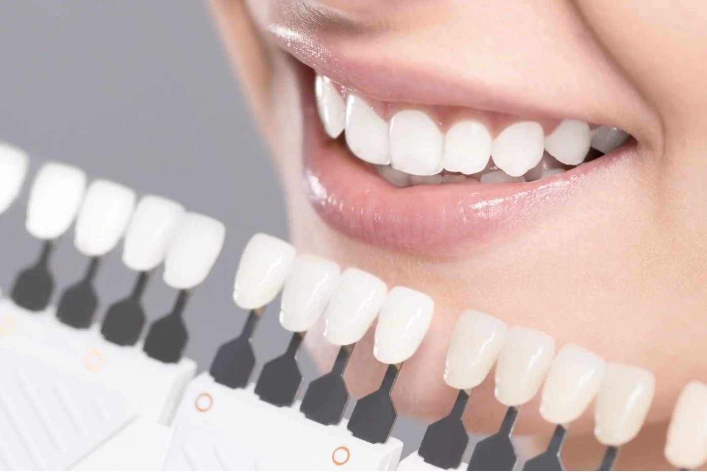 Teeth Whitening in Singapore: What Is Safe, What Works, &amp; 8 Common Myths Addressed (2026)