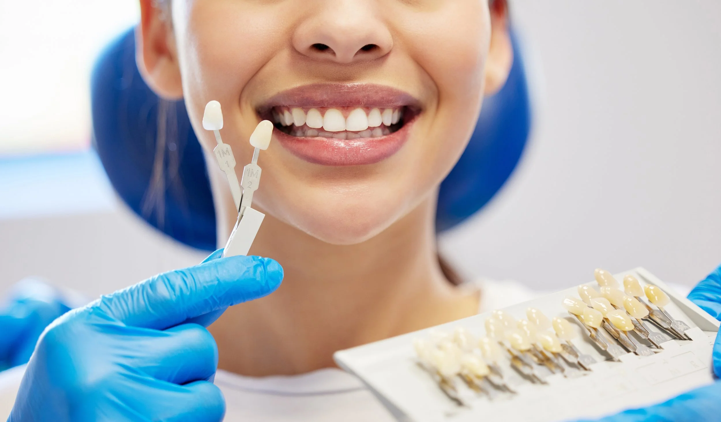 Teeth Whitening Singapore