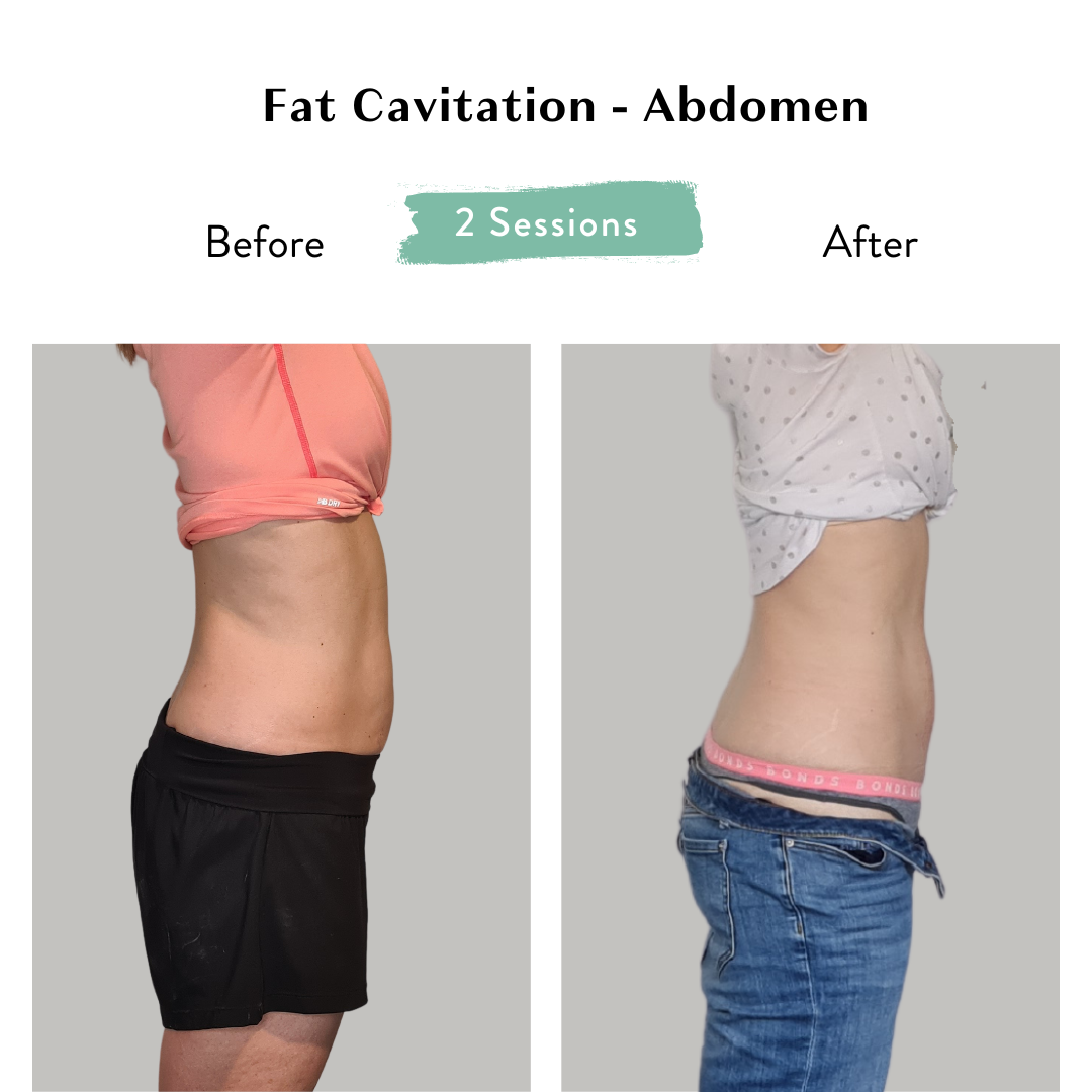 KD Tummy Session 2.png
