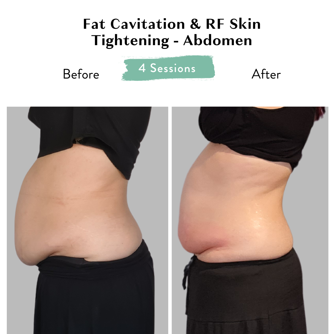 Website Before and After 1 (1).png