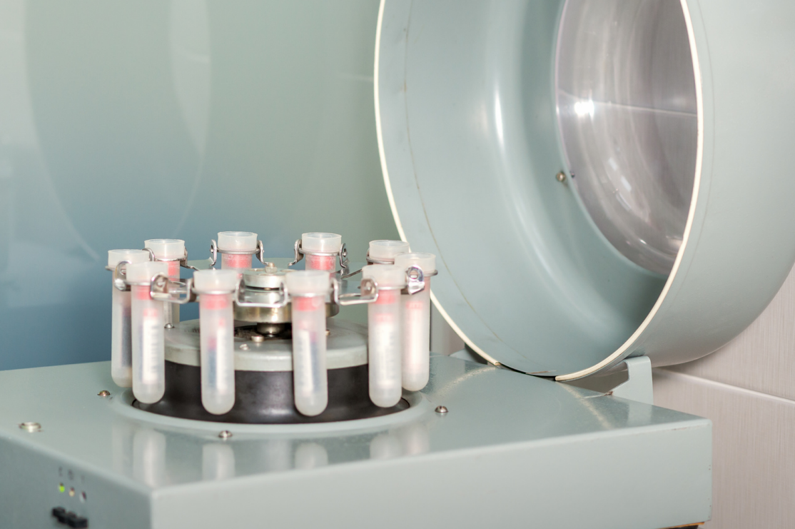 Medical centrifuge with test tubes inside for laboratory analysis.