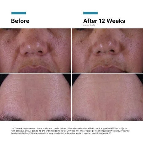 WFP-2136000_SKC-W26-Ecomm-AltImages-PTIOXCream_12_Product_Before+_After 01.jpg