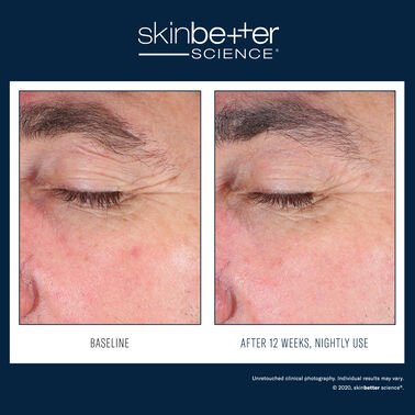Eyemax Alpharet Overnight Cream 2.jpg