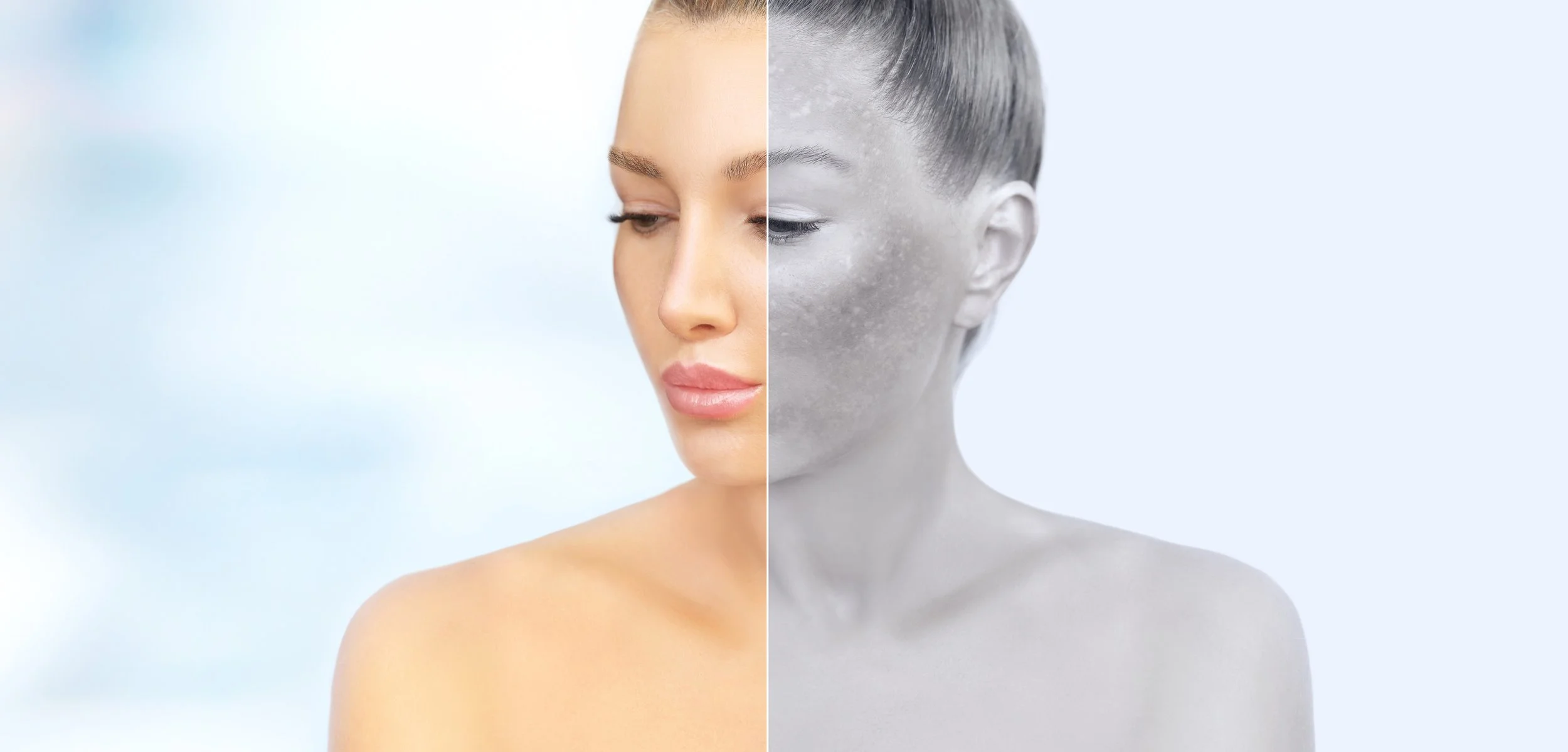 A split image of a woman, with the left side in color showing healthy skin, and the right side in black and white showing skin with acne.