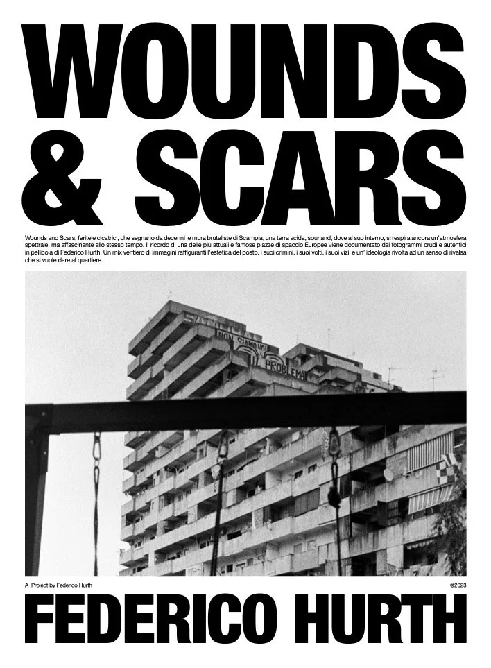 Wounds & Scars