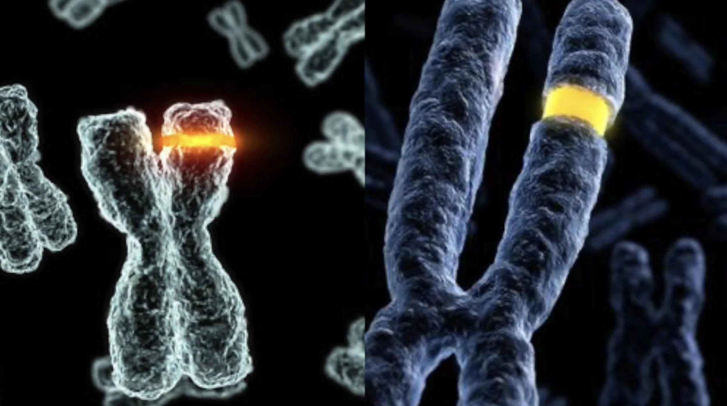 An Inherited Intellectual Disability