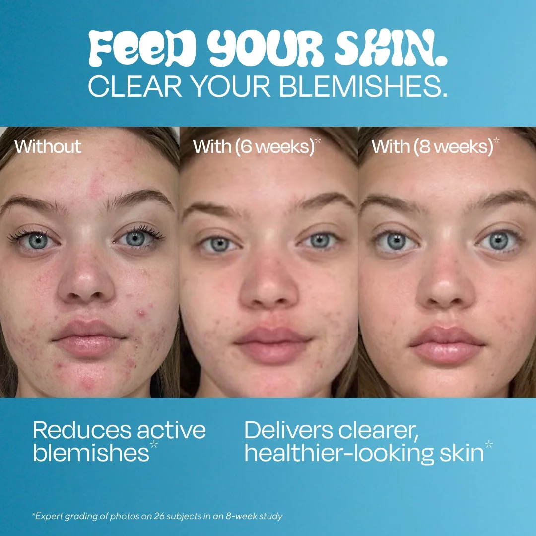 754200_BB_Acne_Serum_Conversion4_PaidSocial_Static_1x1.jpg